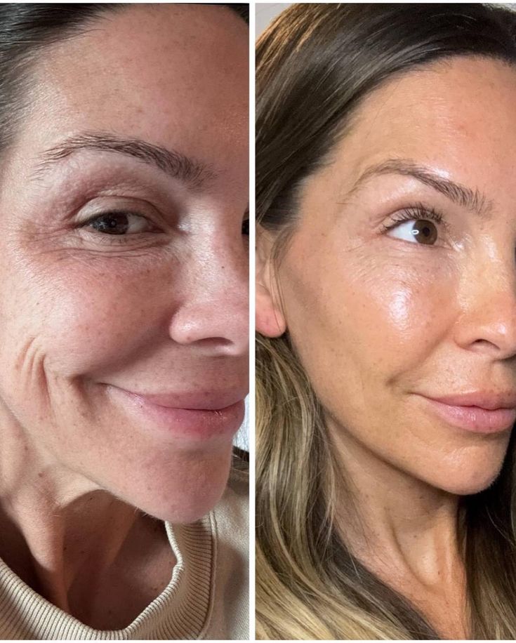 Magic Stick Lifting al Collagene Rosa e PDRN