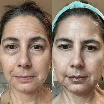 Magic Stick Lifting al Collagene Rosa e PDRN